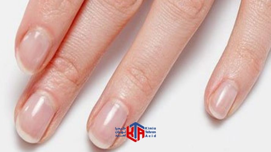 جوش شیرین برای ناخن